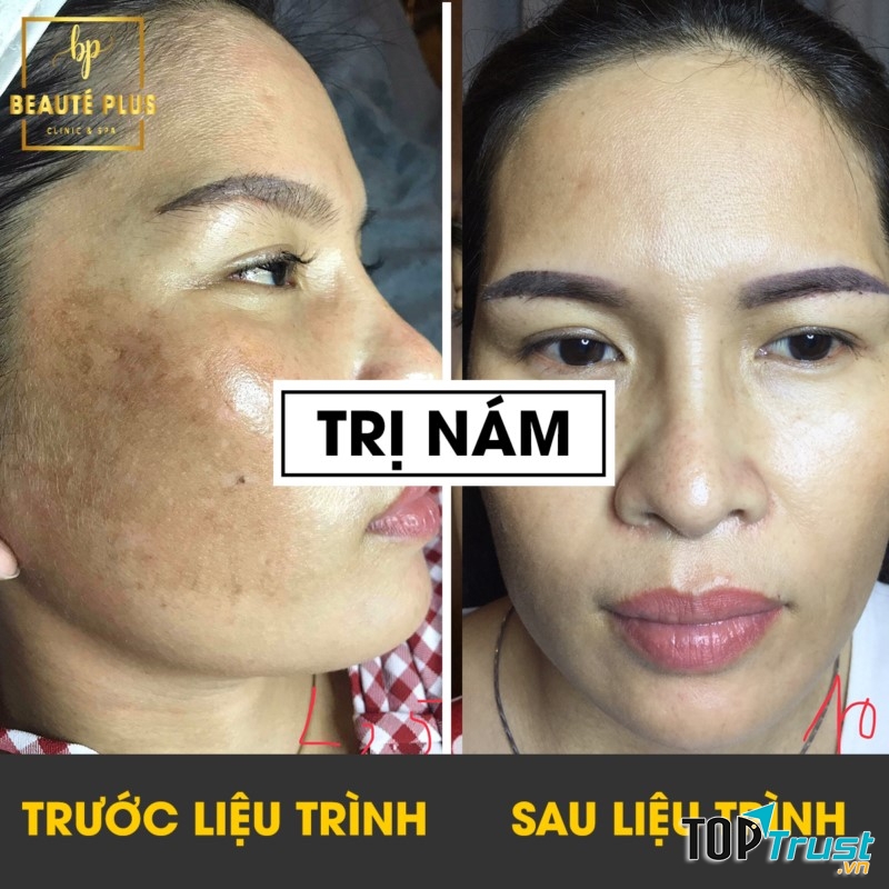 BEAUTÉ PLUS CLINIC & SPA