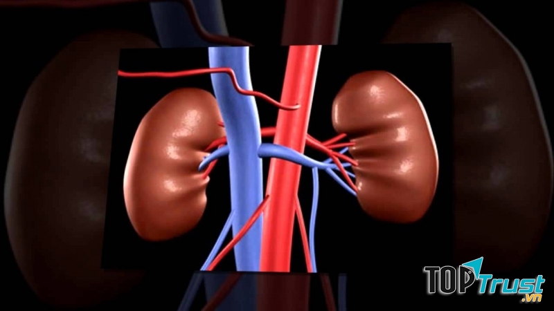 Bệnh thận hư là mối lo của nhiều chị em phụ nữ