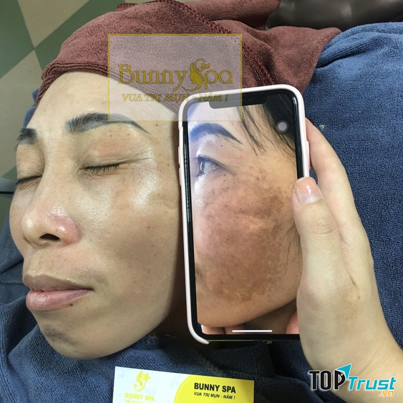 Sự khác biệt giữa trước và sau điều trị