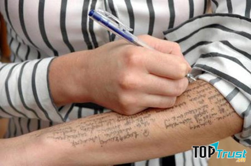 Cánh tay thần kỳ