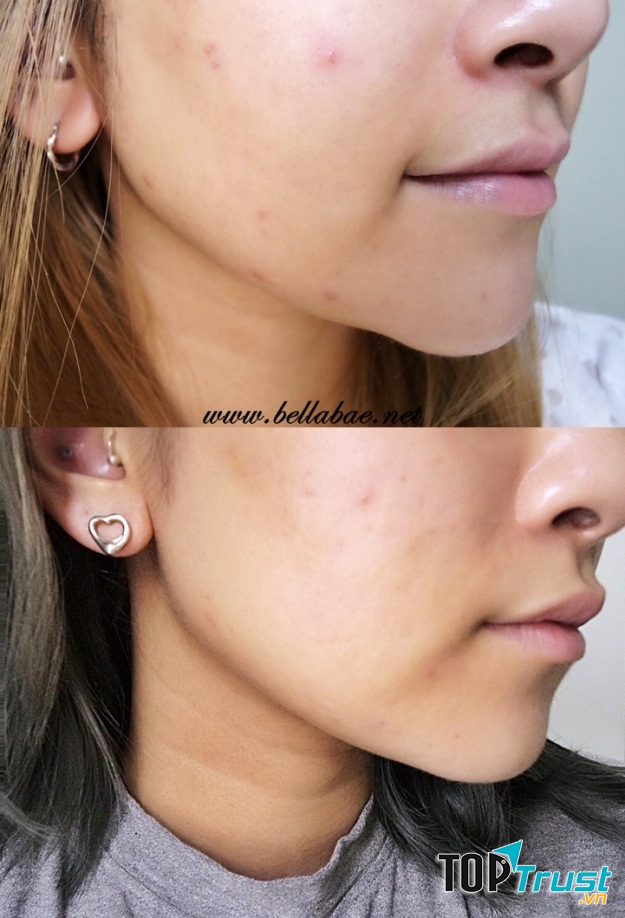 Hiệu quả trước và sau khi sử dụng sản phẩm.