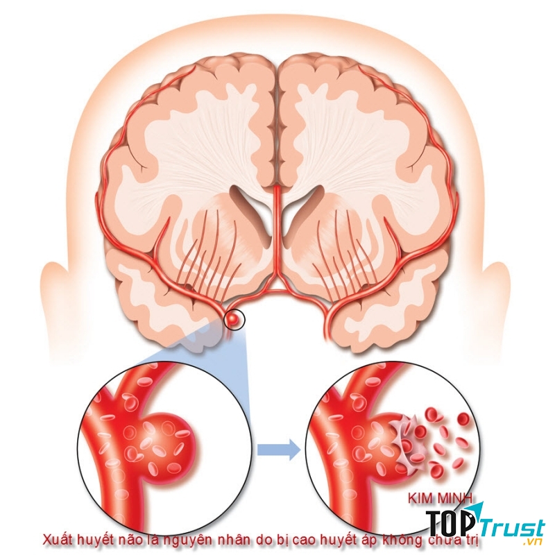 Cải thiện trí não.
