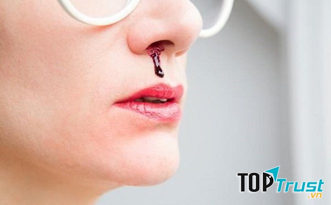 Khắc phục tình trạng chảy máu mũi.