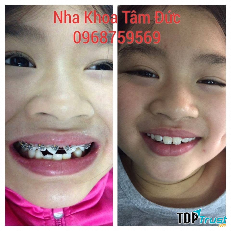 Nha khoa Tâm Đức