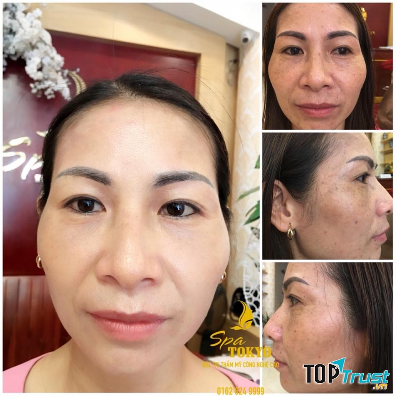 Spa Tokyo giúp khách hàng lấy lại vẻ đẹp thanh xuân