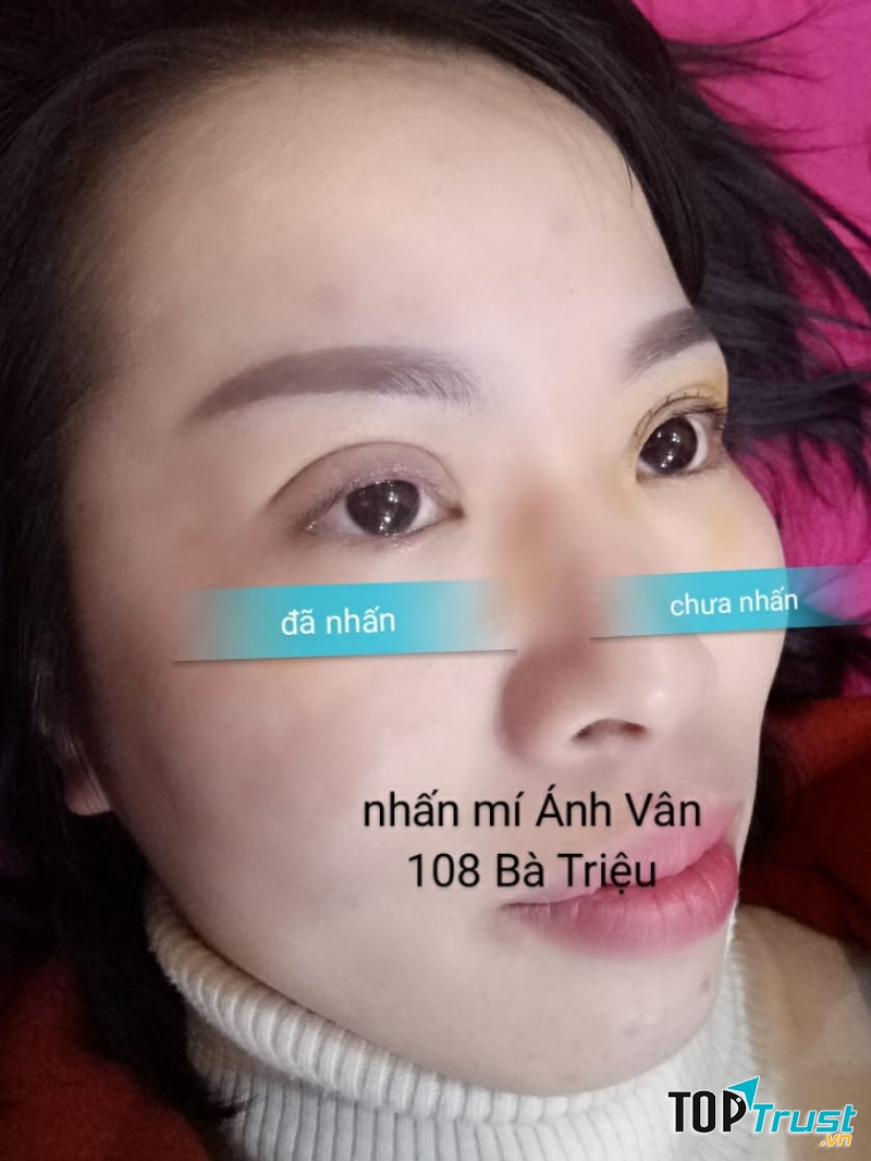 Thẩm Mỹ Ánh Vân‎