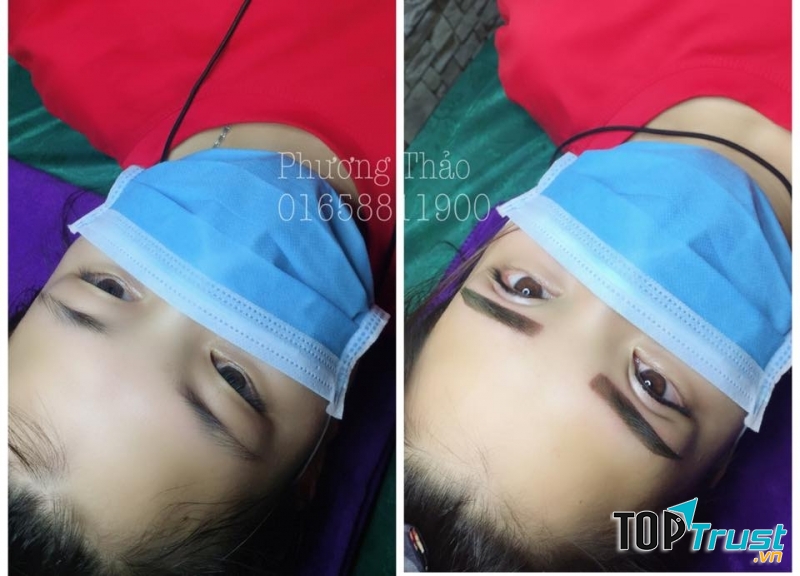 Thẩm mỹ Phương Thảo