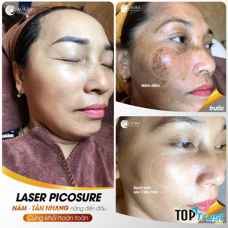 Thẩm Mỹ Viện Quốc Tế Aura