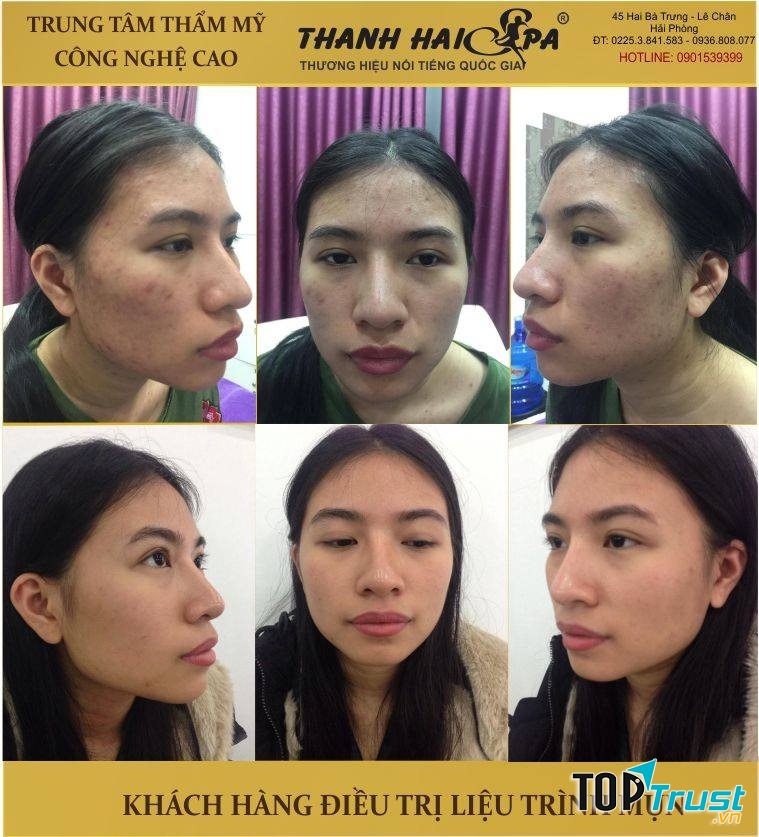 Thanh Hải Spa