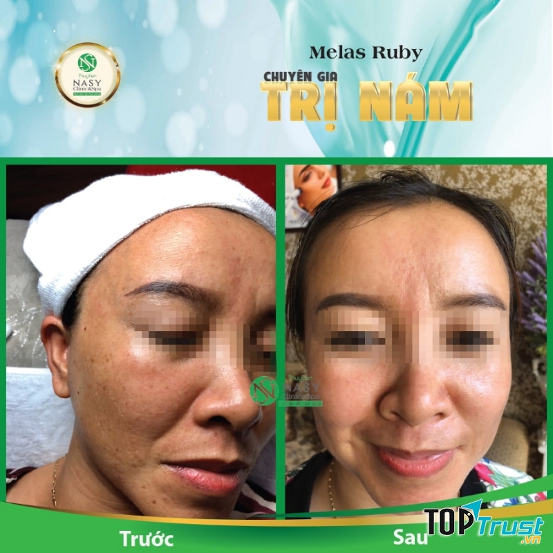 Thủy Tiên Nasy Clinic & Spa