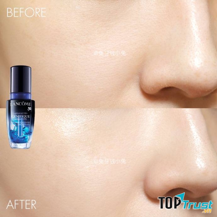 Tinh chất kép kết hợp quyền năng trẻ hóa da và những nhân tố làm dịu làn da nhạy cảm Lancôme Advanced Génifique Sensitive Antioxidant Serum