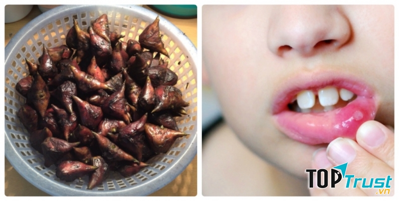 dùng củ ấu kết hợp các vị thuốc để chữa mụn nhọt nhiệt miệng ở trẻ nhỏ