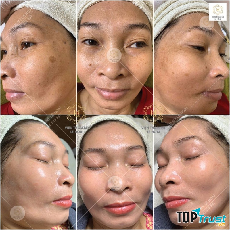 Viện Thẩm Mỹ Lê Hoài