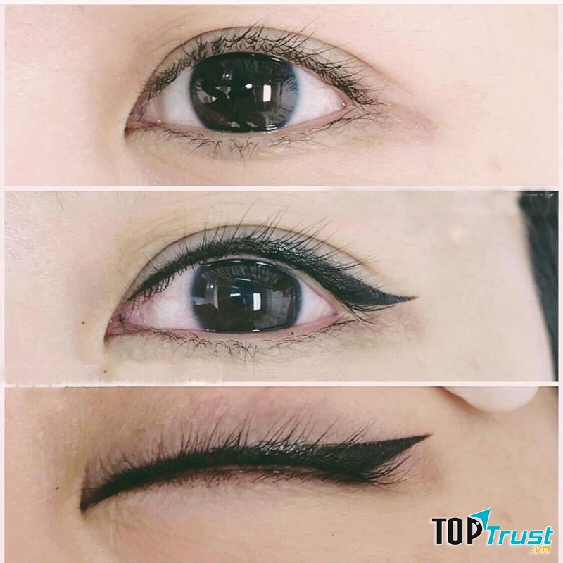 Viện thẩm mỹ quốc tế Linh Anh