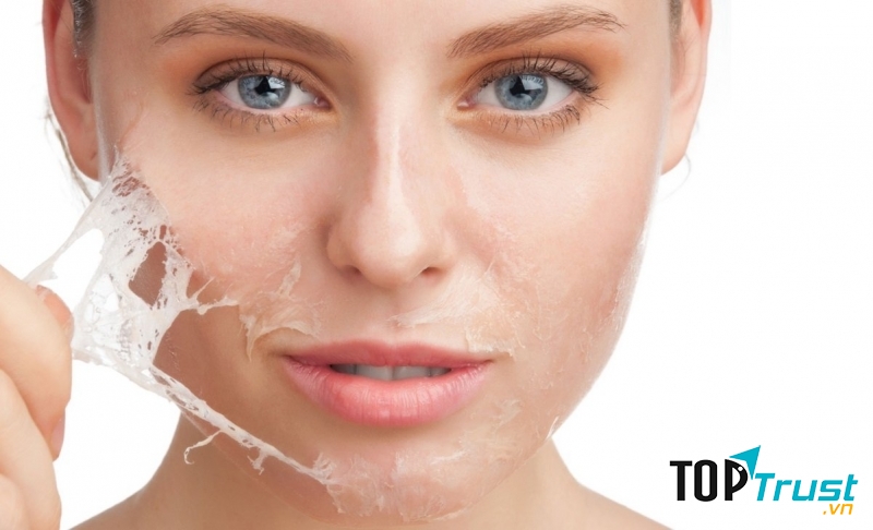 Một số vấn đề về da