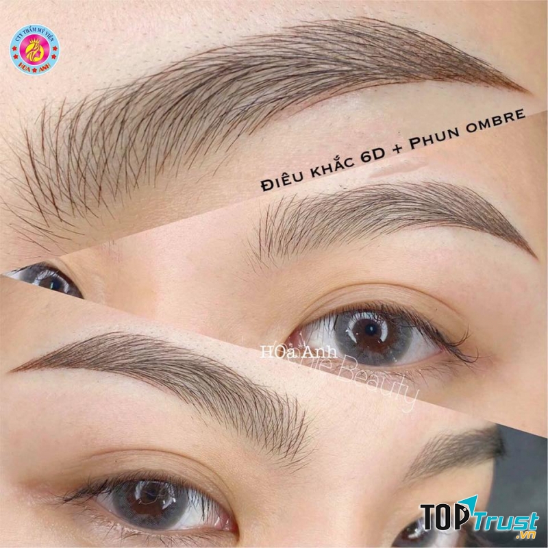 Thẩm Mỹ Viện Hoa Anh