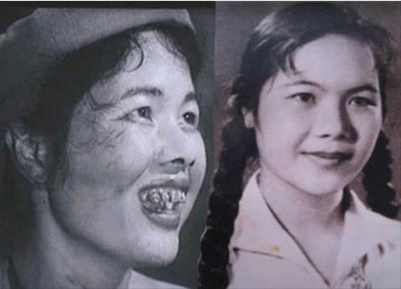 Ảnh minh họa (Nguồn internet)