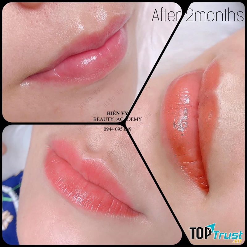 Thẩm Mỹ Hiền Vy