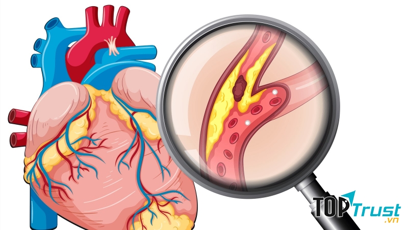 19-21 giờ: Thời gian giải độc màng ngoài tim