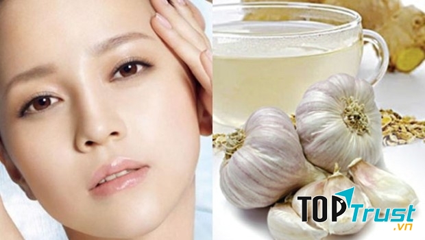 Trị mụn bằng tỏi và mật ong