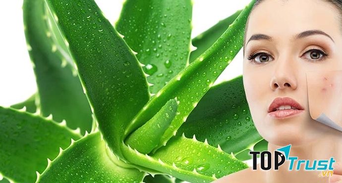 Trị mụn bằng nha đam tại nhà