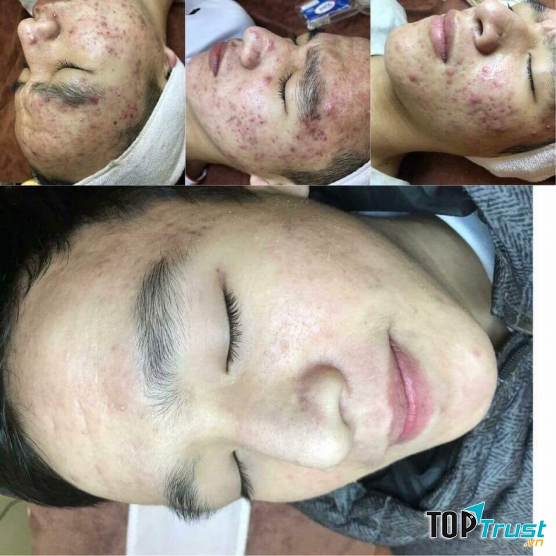 Alisa Spa Thanh Hóa