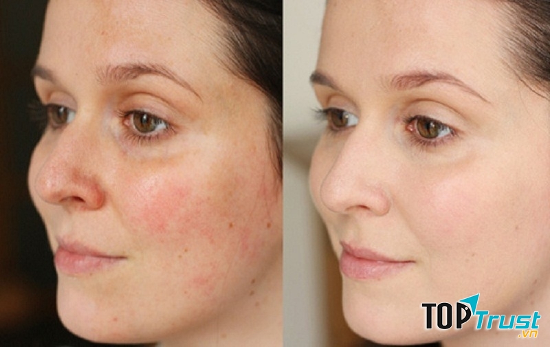 Almay Clear Complexion