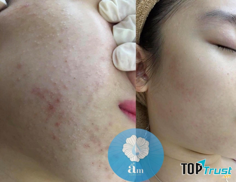 Ẩm Clinic & Spa _ Hải Phòng