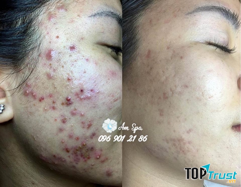 Ẩm Spa & Clinic
