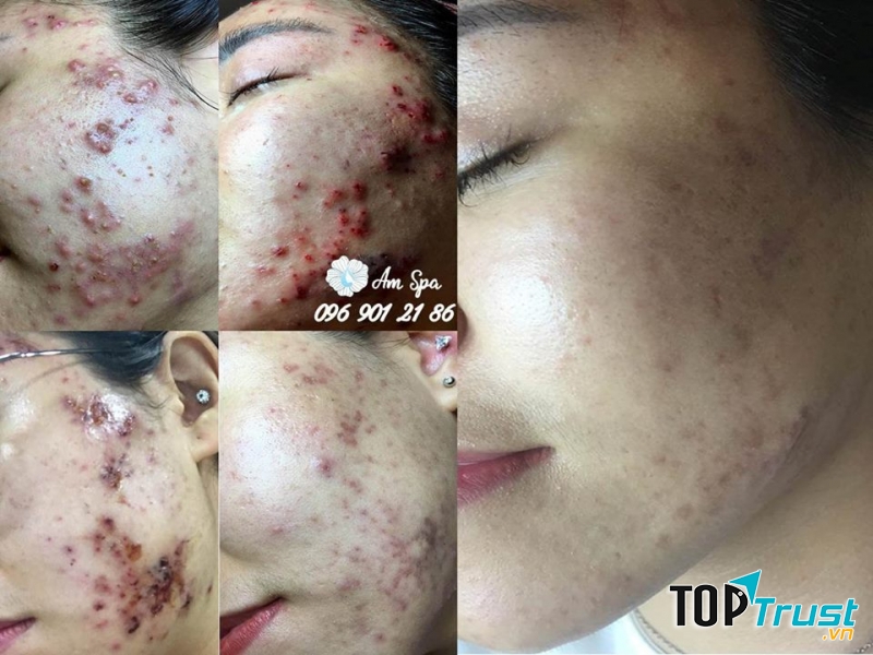 Ẩm Spa & Clinic