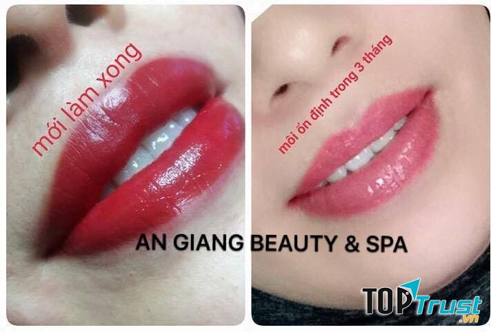 Ảnh môi của khách hàng làm tại An Giang Beauty & Spa