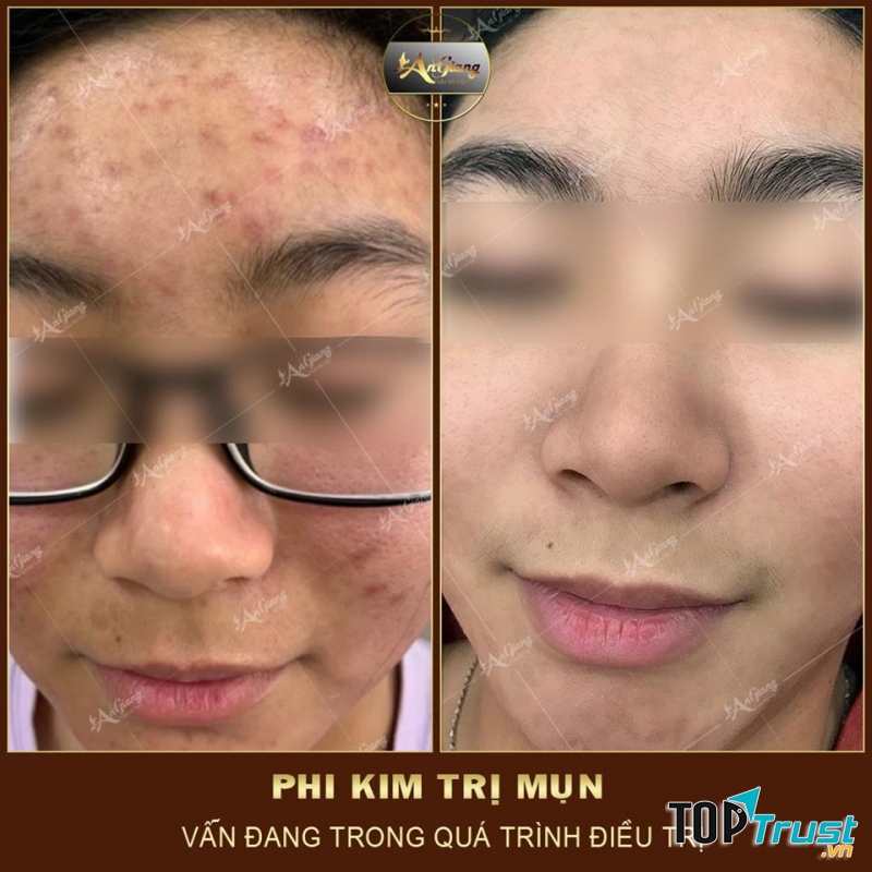 An Giang Beauty & Spa