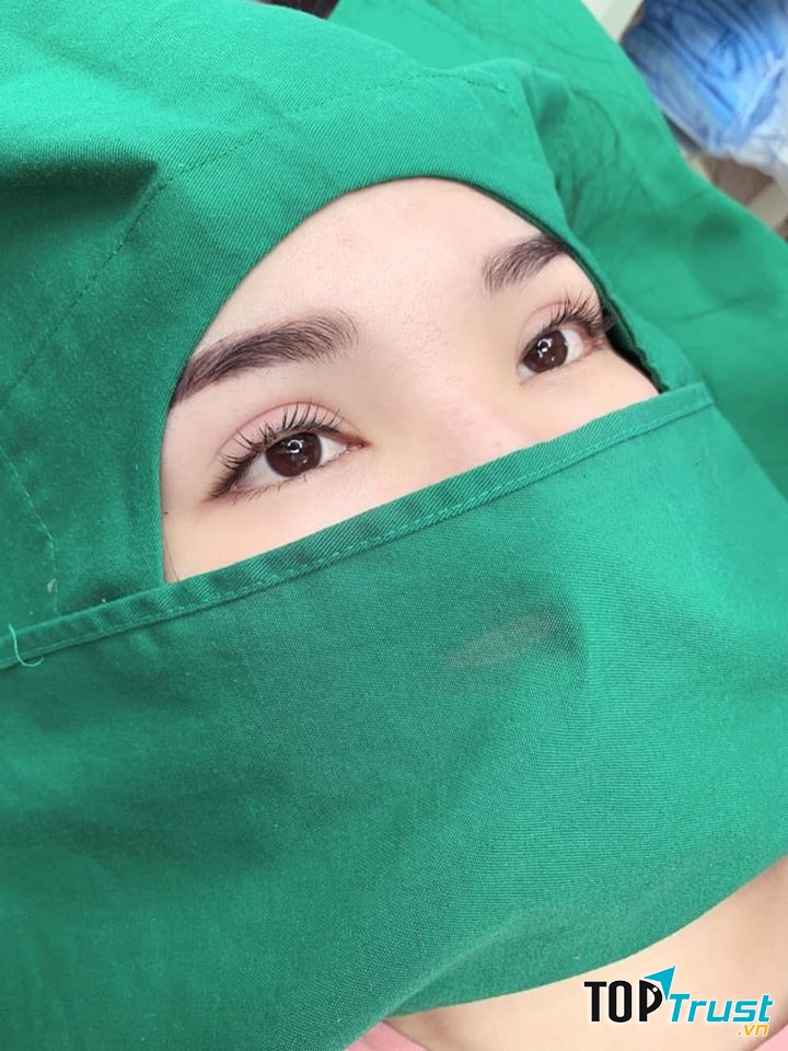 Nhấn mí cực xinh tại An Spa Beauty Center