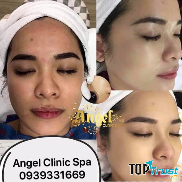 Angel Clinic Spa