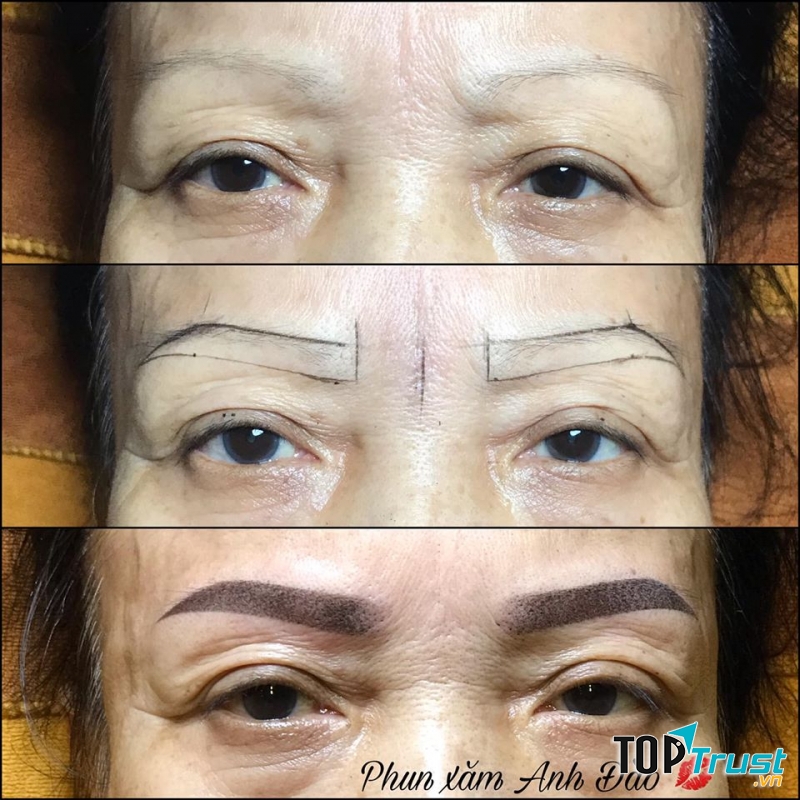 Anh Đào Beauty & Spa