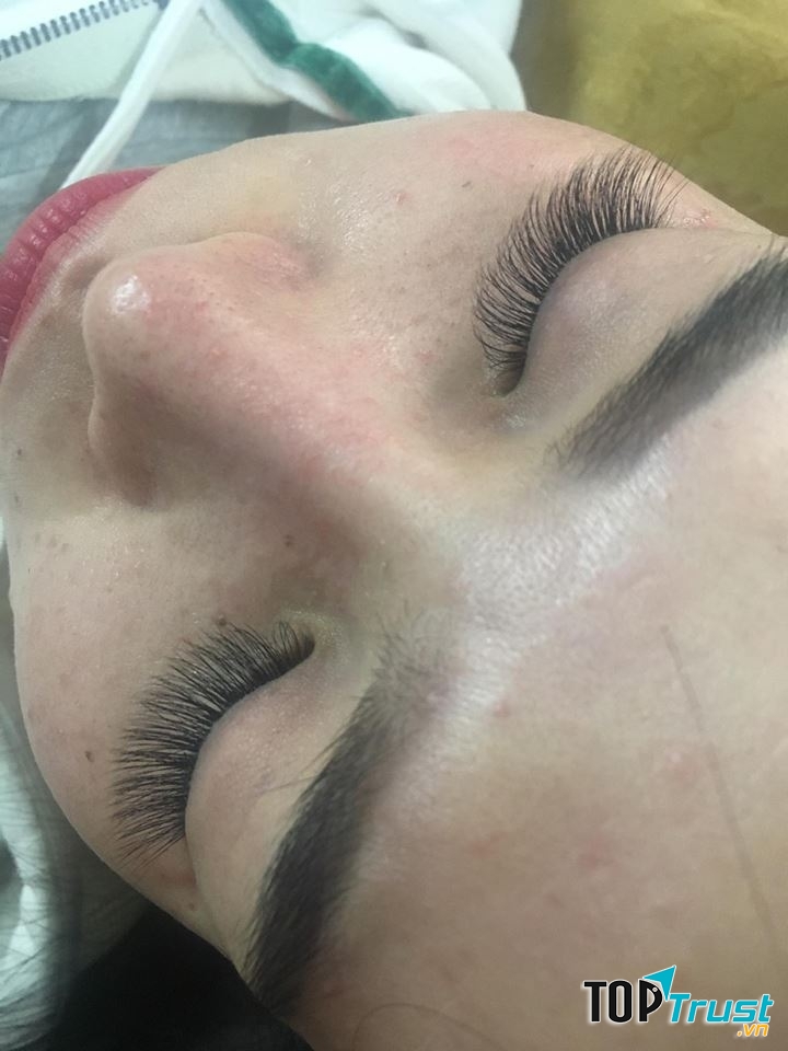 Ánh Dương Nối Mi