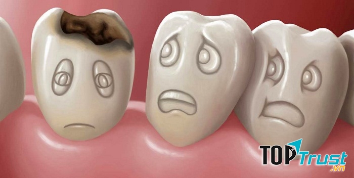 Sử dụng nước ngọt khiến răng bị sâu.