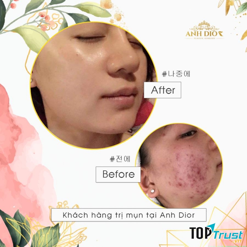 AnhDior Beauty