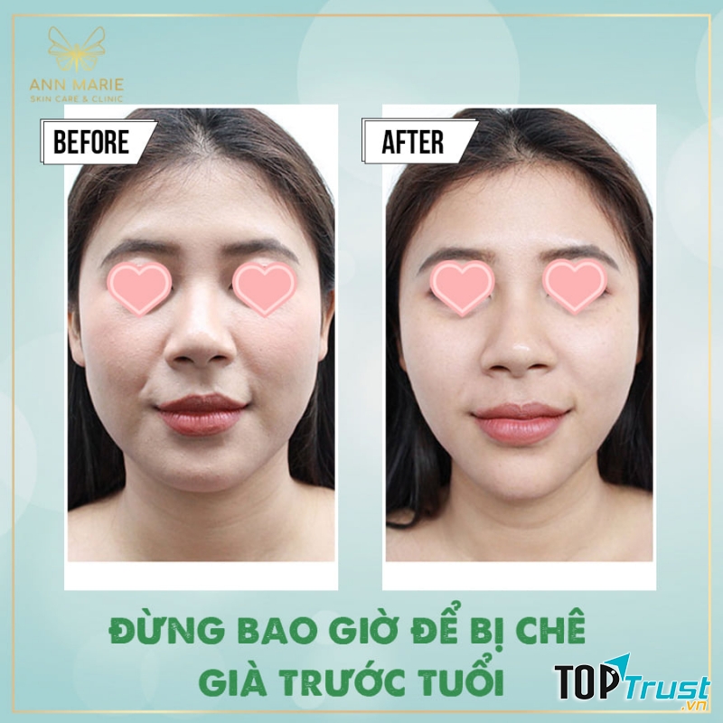 Ann Marie Spa - Skincare & Clinic