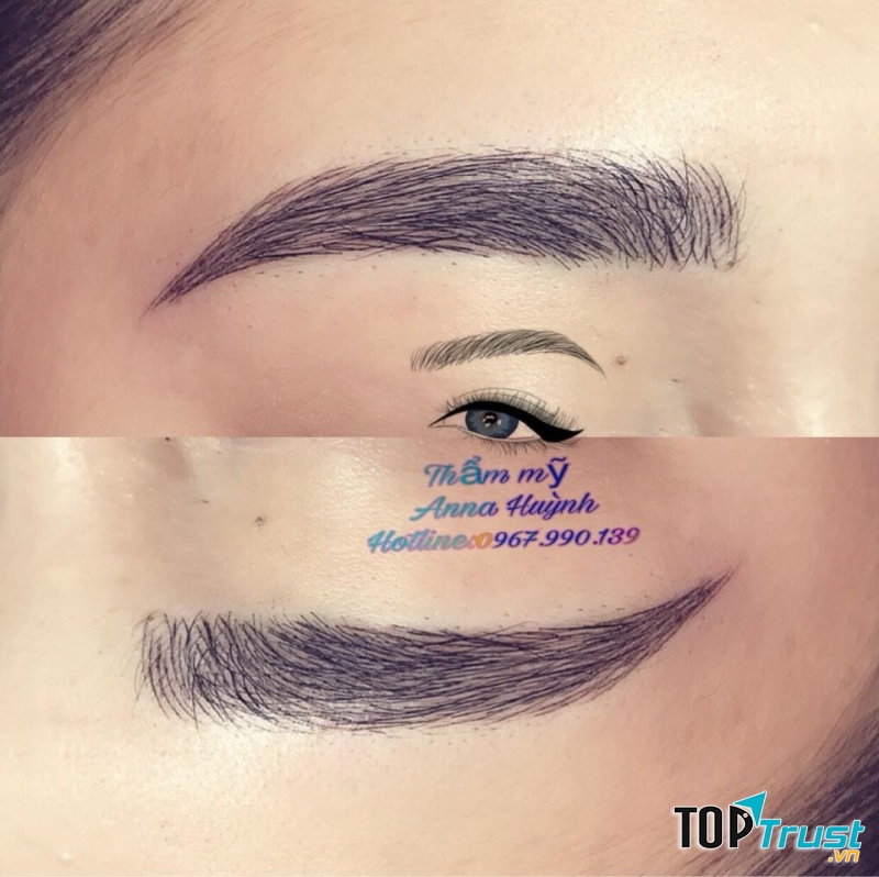 Thẩm mỹ Anna Huỳnh