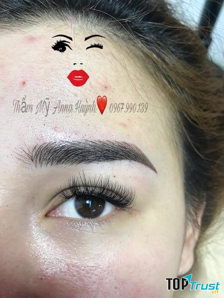 Thẩm mỹ Anna Huỳnh