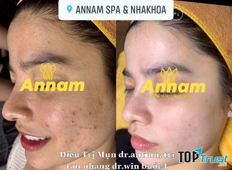 Annam Spa