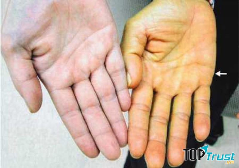 Ảnh minh họa (Nguồn Internet)