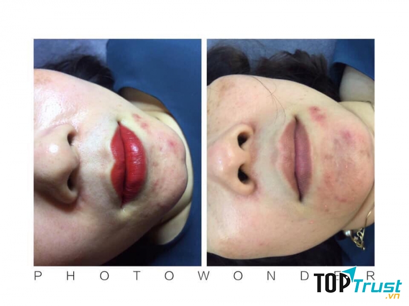 Arum Spa - Care & Beauty