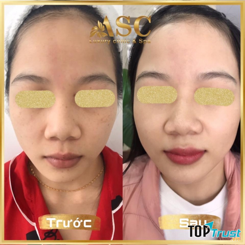 ASC luxury Clinic & Spa