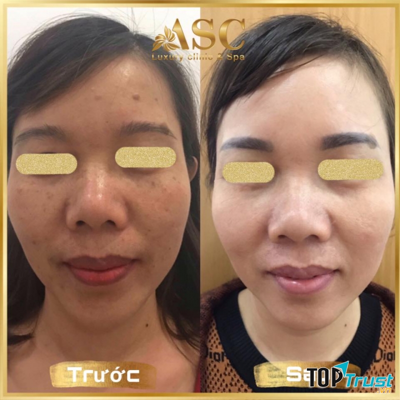 ASC luxury Clinic & Spa