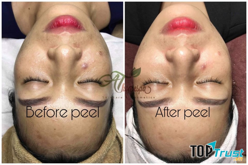 AThomespa