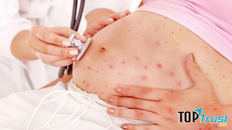 Trên da xuất hiện những mảng đỏ và ngứa