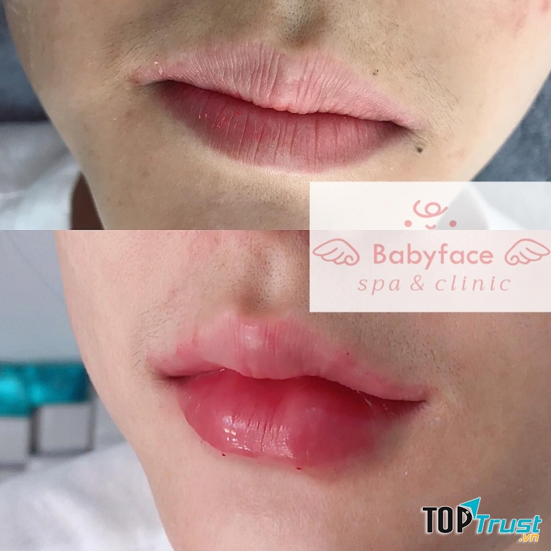 Baby Face Spa & Clinic