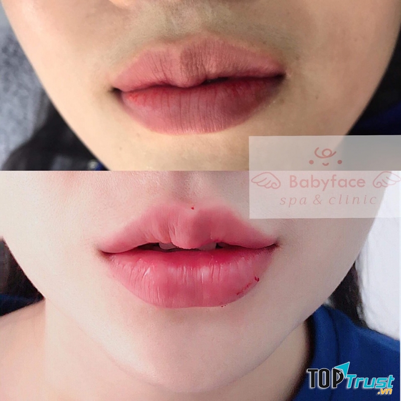 Baby Face Spa & Clinic